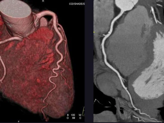 CT or Invasive Coronary Angiography in Stable Chest Pain
