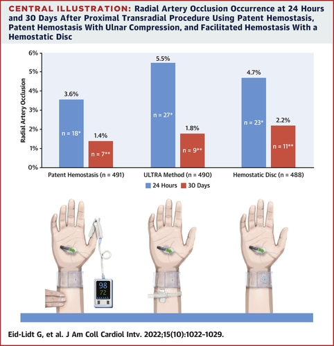 Prevention of Radial Artery Occlusion of 3 Hemostatic Methods in Transradial Intervention for Coronary Angiography